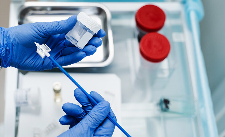 Pap Smear