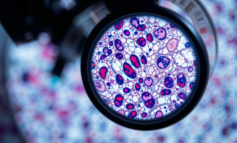 Histopathology