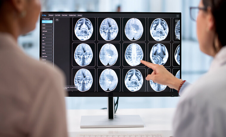 CT Scan