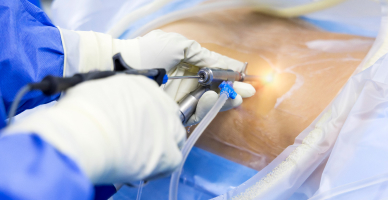 Cerebrospinal Fluid Diversion
