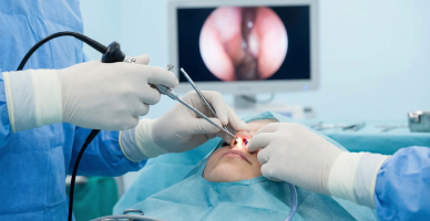 Endoscopic Endonasal Surgery