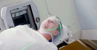 Stereotactic Radiotherapy