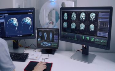 Multiparametric Prostate MR