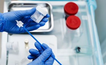 Pap Smear