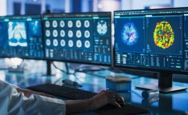 PET-CT