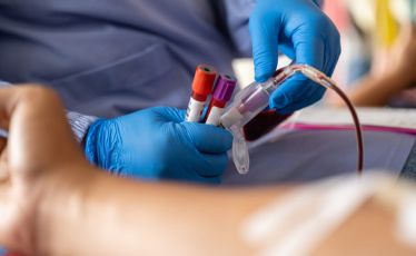 EBV Testing