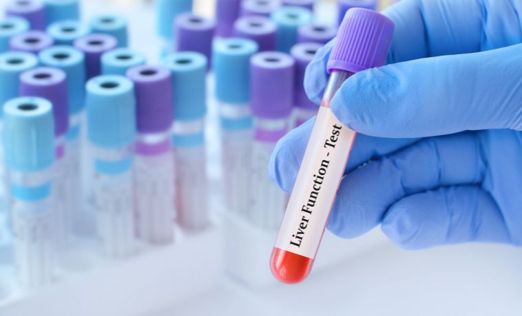Liver Function Tests