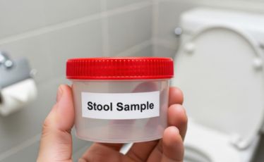 Stool Tests