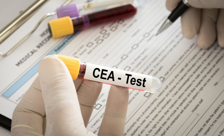 CEA