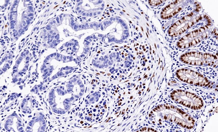 Immunohistochemistry