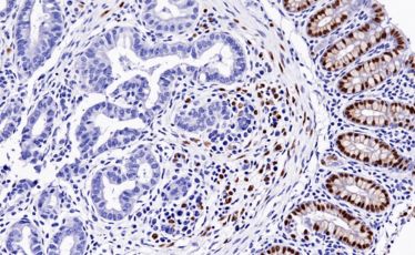 Immunohistochemistry