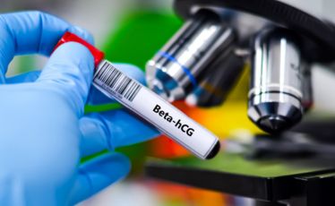 Beta-hCG
