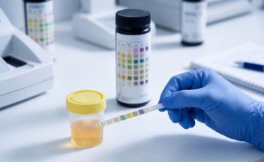 Urinalysis