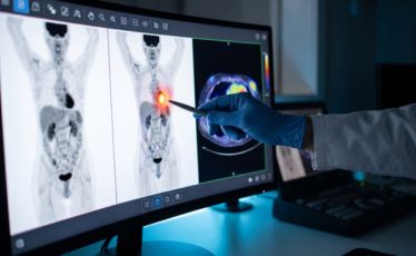 PET-CT