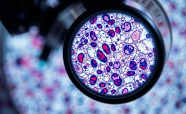 Histopathology