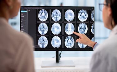 CT Scan