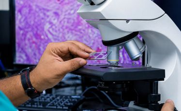 Cerebrospinal Fluid Cytology