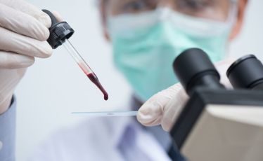 Peripheral Blood Smear