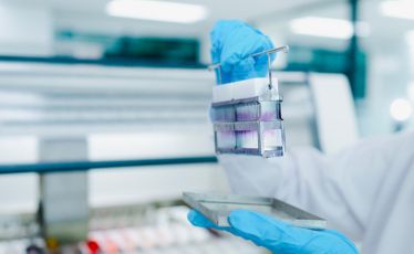 Immunohistochemistry