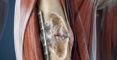 Nerve and Blood-Vessel Reconstruction