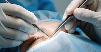 Eyelid Reconstruction