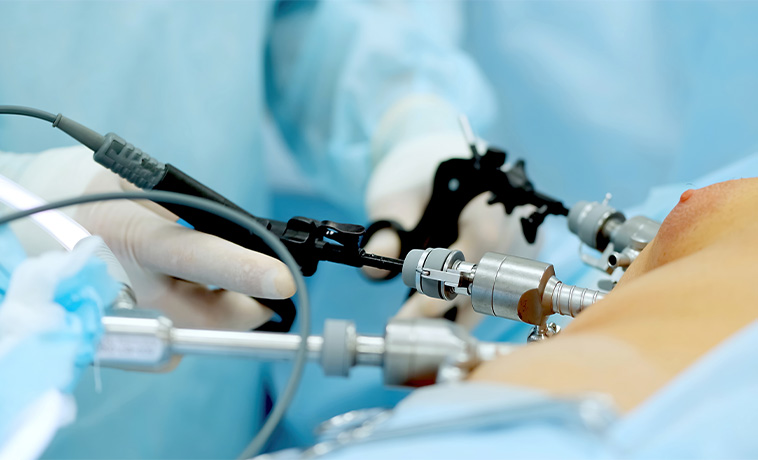 Endoscopic Resection