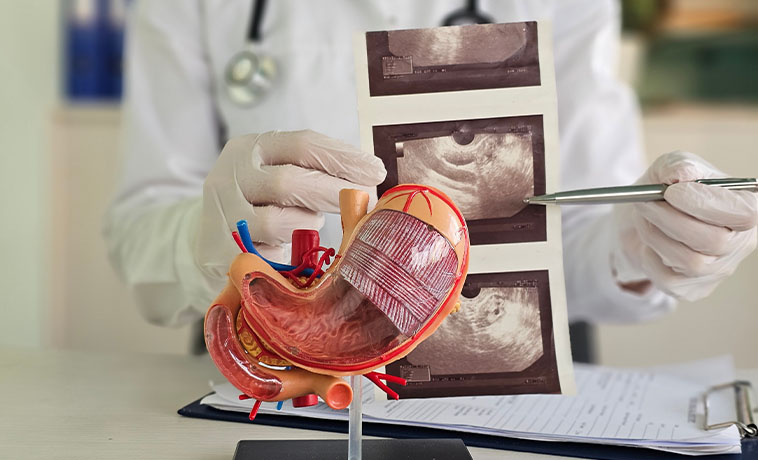 Endoscopic Ultrasound-Guided Biopsy