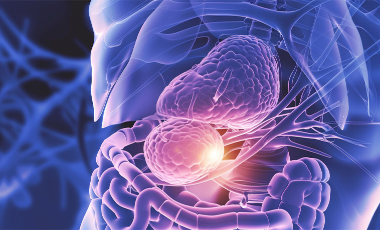 ERCP Sampling