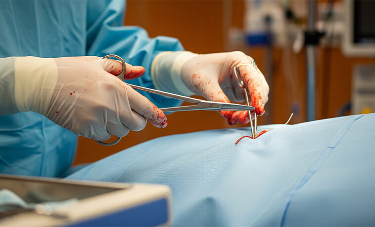 Surgical Biopsy
