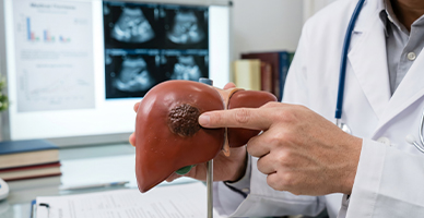 Radioembolisation