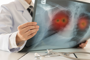 Non-Small Cell Lung Cancer
