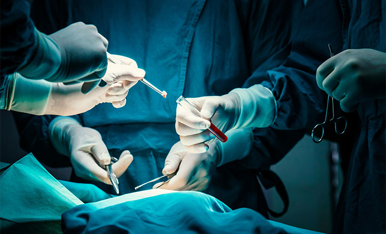 Bronchoscopy-Guided Biopsy