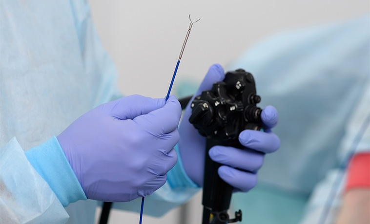 Esophageal reconstruction