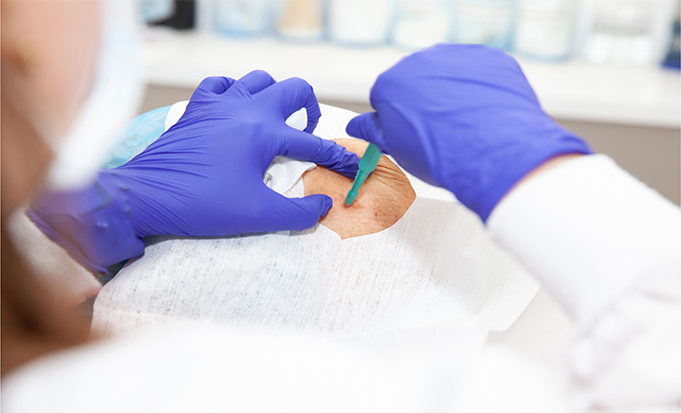 soft tissue reconstruction