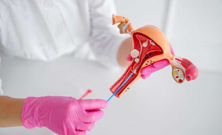Vaginal Biopsy