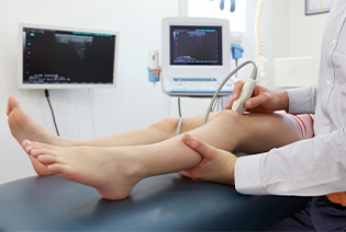Ewing Sarcoma