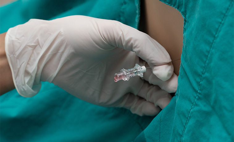 Lumbar Puncture