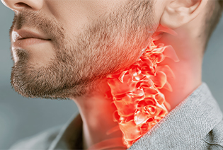 Hypopharyngeal Cancer