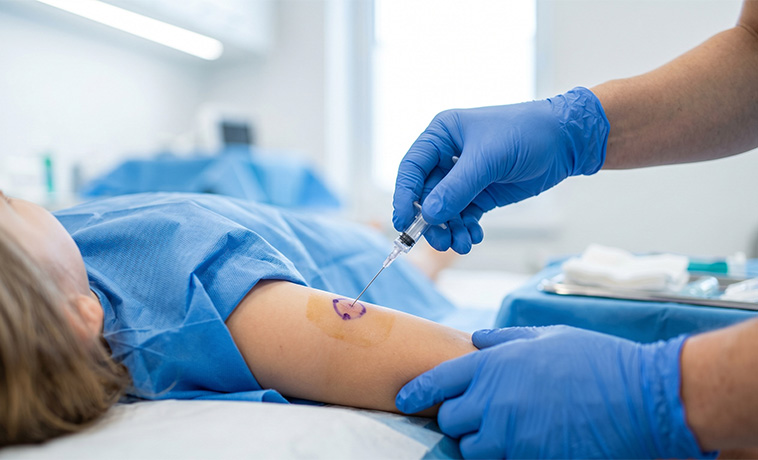 Fine-Needle Aspiration Cytology