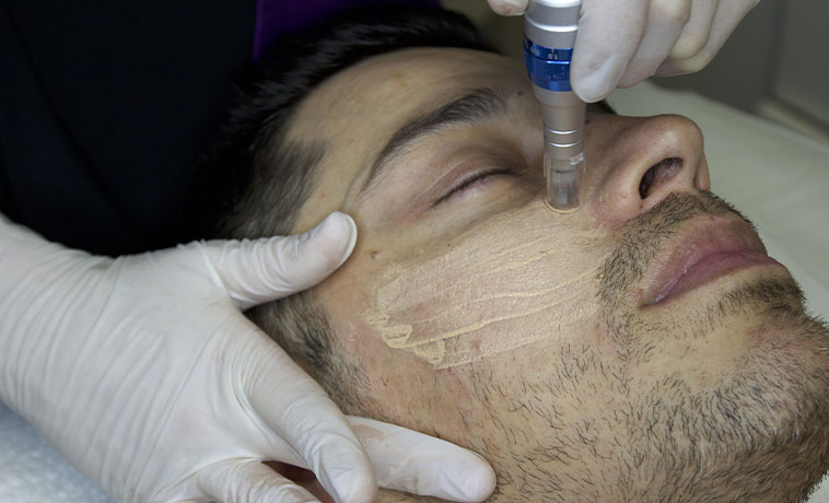 Facial Reanimation