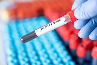 Multiple Myeloma