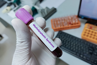 Myelodysplastic Neoplasms