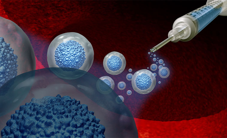 Autologous Stem-Cell Transplan