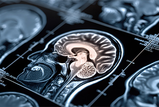 Pituitary Tumour