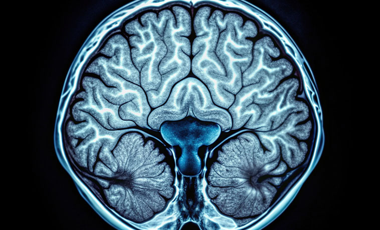 Dural Reconstruction
