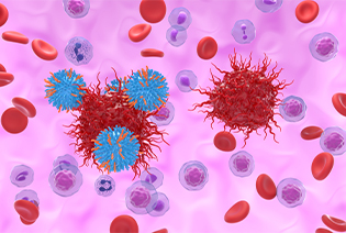 Neuroendocrine Tumours (NETs)