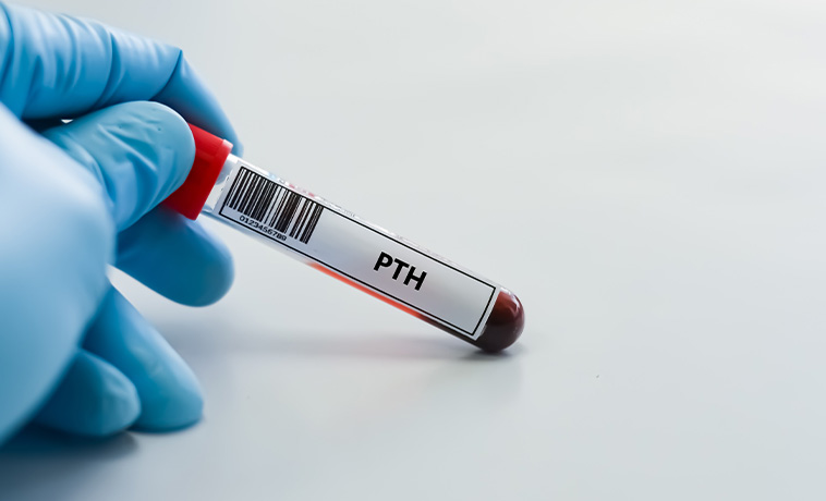 Calcium and Parathyroid Hormone
