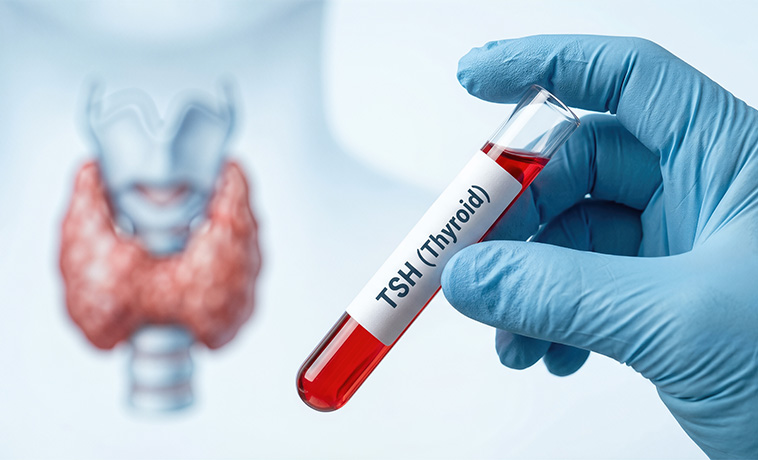 Thyroid Tests