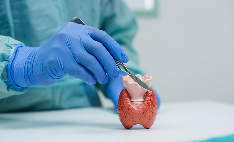 Thyroid Surgery