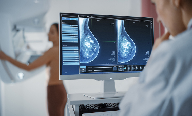 3D Breast Tomosynthesis